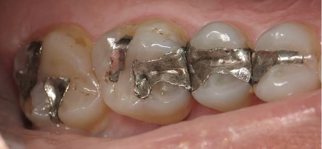 Foothill Smiles photo