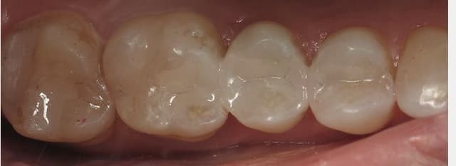 Foothill Smiles photo