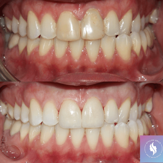 Irvine Tooth Cafe & Orthodontics photo