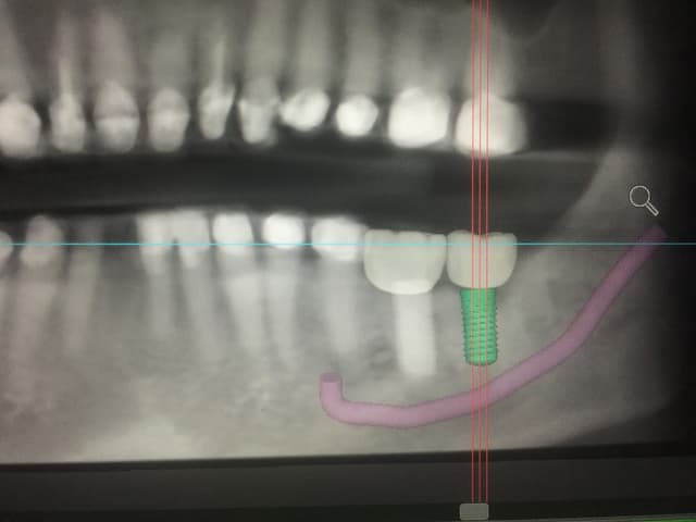 Huntington Beach Oral and Maxillofacial Surgery photo