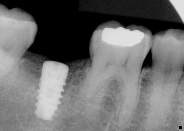 Huntington Beach Oral and Maxillofacial Surgery photo