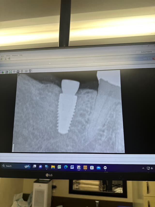 Huntington Beach Oral and Maxillofacial Surgery photo