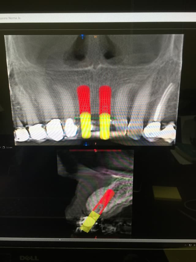 Huntington Beach Oral and Maxillofacial Surgery photo