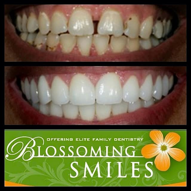 Blossoming Smiles photo
