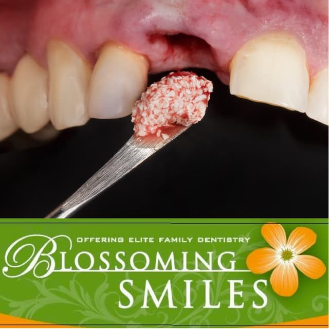 Blossoming Smiles photo