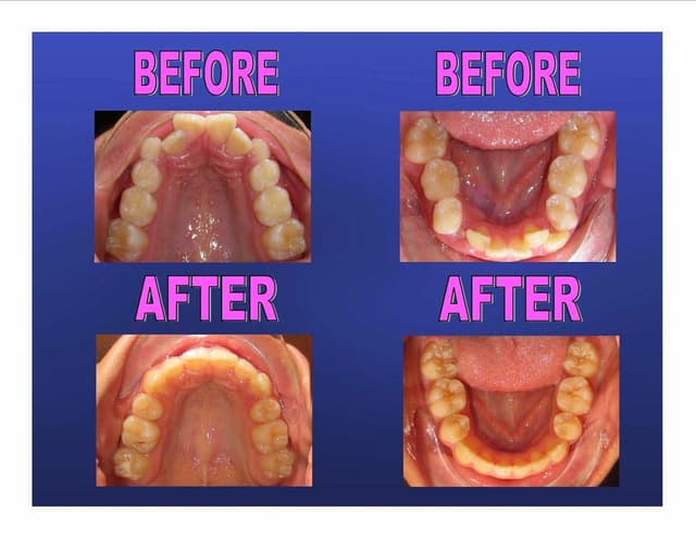 Ting Orthodontics photo