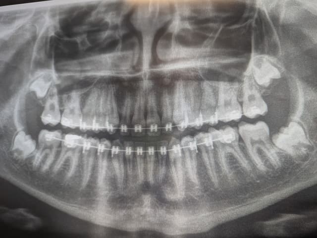 Wemmer Family Orthodontics - Sebastian photo