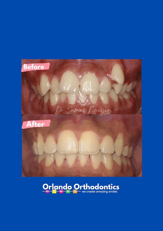 Orlando Orthodontics photo