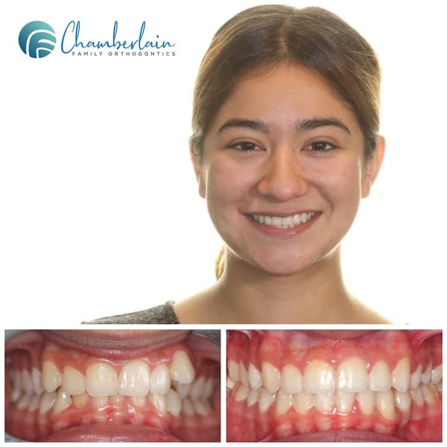 Chamberlain Family Orthodontics photo