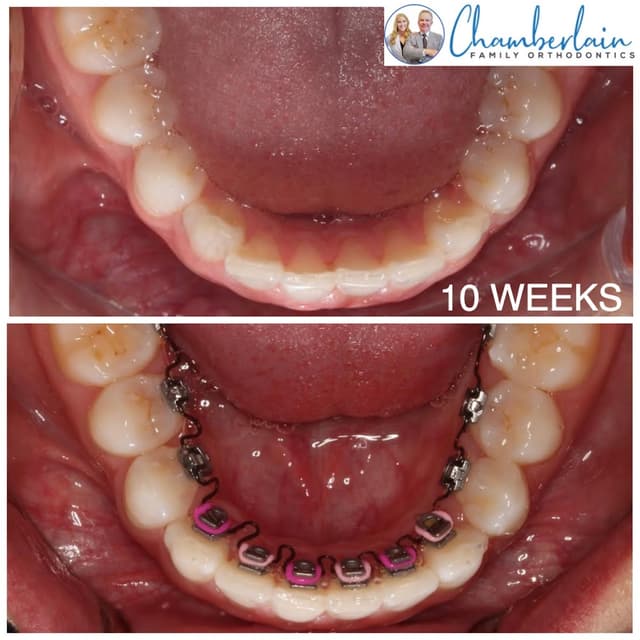 Chamberlain Family Orthodontics photo