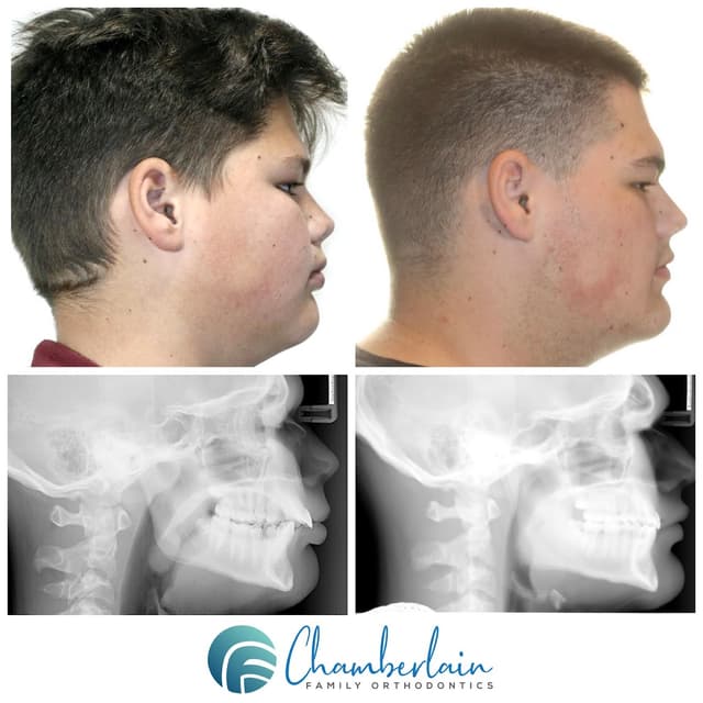 Chamberlain Family Orthodontics photo
