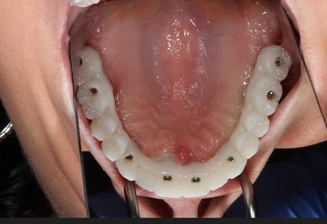 Roc Perio & Implants photo