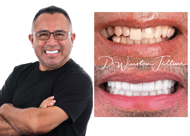 MiraBella Smiles - Cypress, TX photo