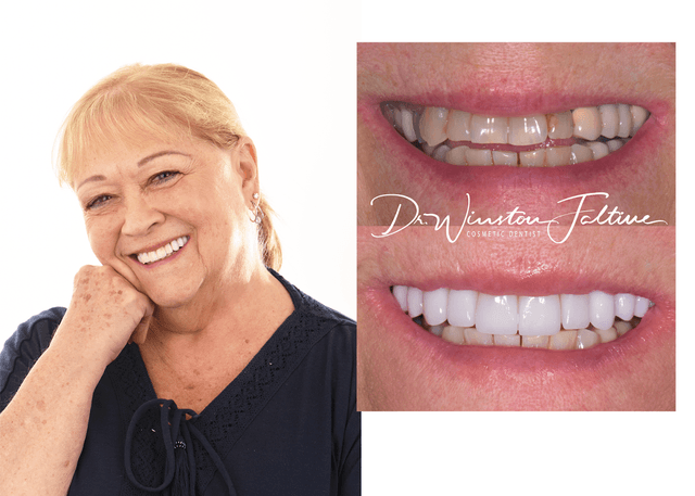 MiraBella Smiles - Cypress, TX photo