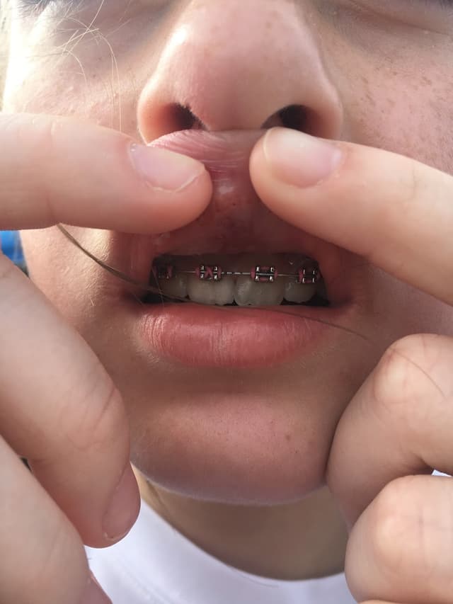 Hill Orthodontics photo