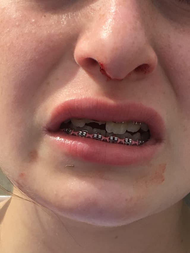 Hill Orthodontics photo
