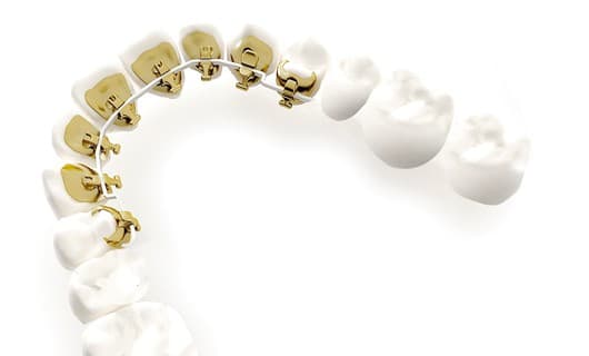 The Schulhof Center for Orthodontics photo