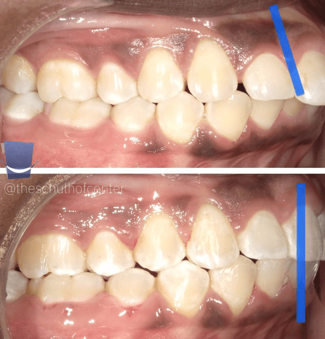 The Schulhof Center for Orthodontics photo