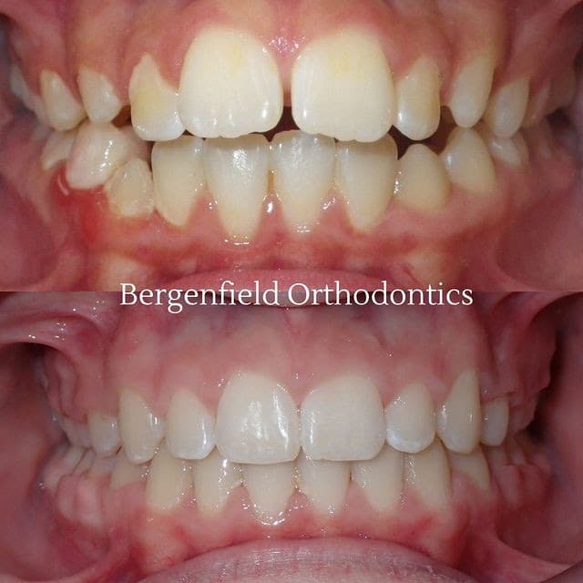 Bergenfield Orthodontics photo