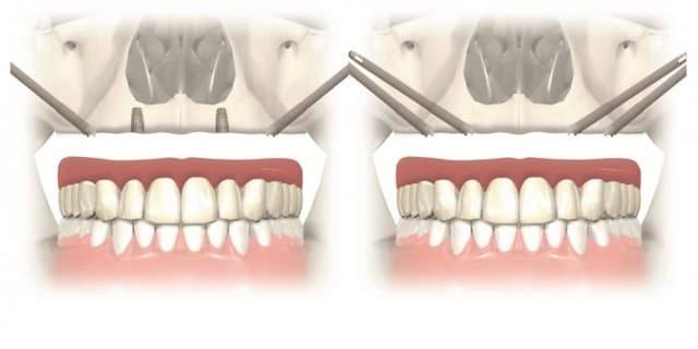 Nevada Oral & Facial Surgery photo