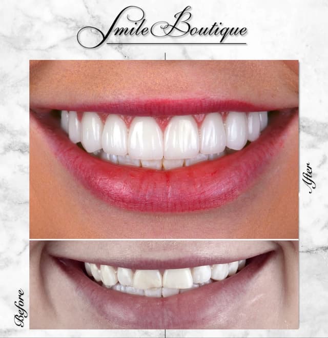 Smile Boutique Beverly Hills photo