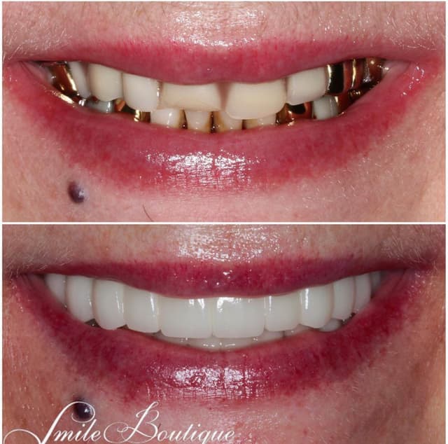 Smile Boutique Beverly Hills photo