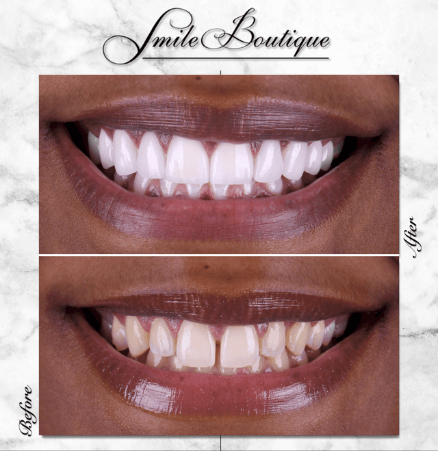 Smile Boutique Beverly Hills photo