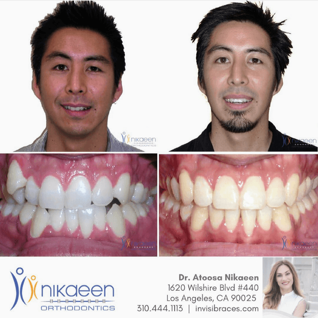 Nikaeen Orthodontics photo