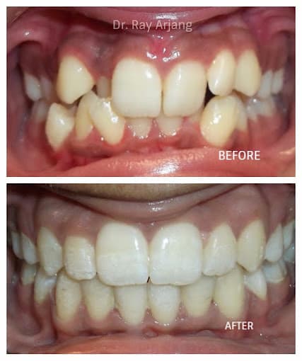 Ray Orthodontics of Huntington Park photo