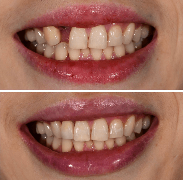Fuller Smiles photo