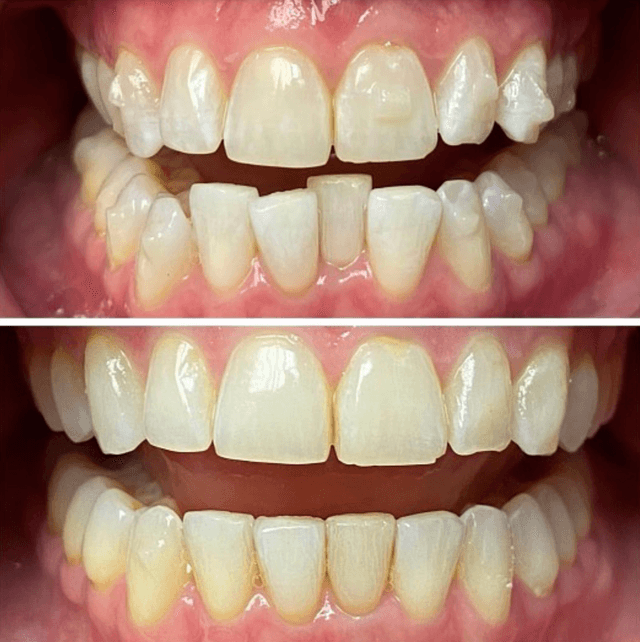 Fuller Smiles photo