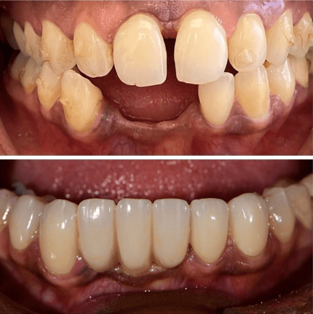 Fuller Smiles photo