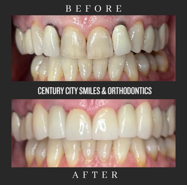 Century City Smiles and Orthodontics photo