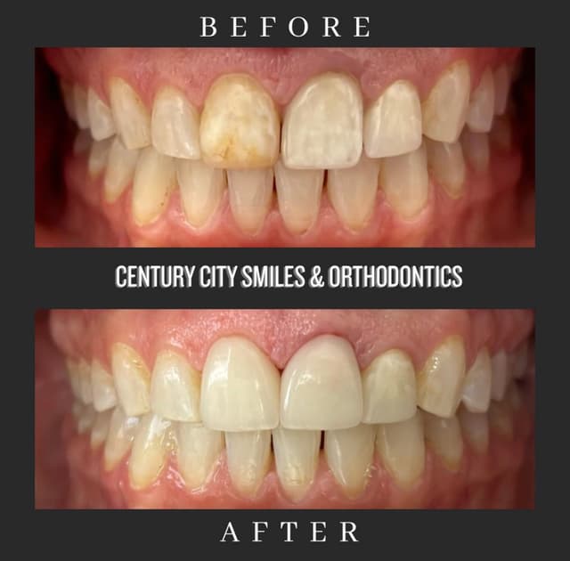 Century City Smiles and Orthodontics photo