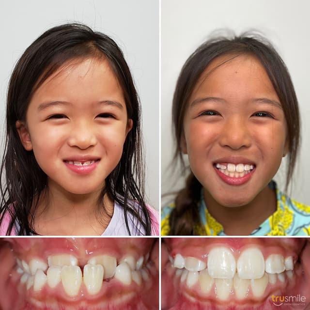 TruSmile Orthodontics photo