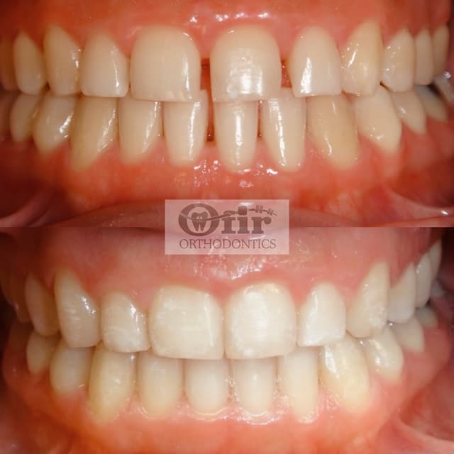 Ofir Orthodontics photo