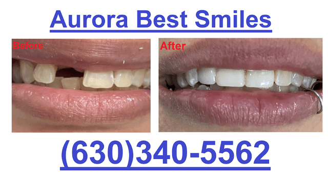 Aurora Best Smiles photo
