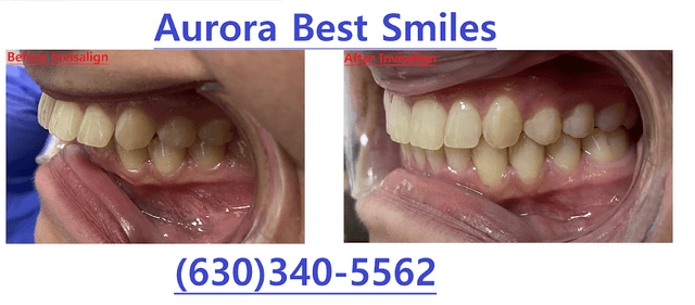 Aurora Best Smiles photo