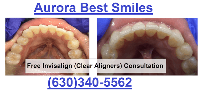 Aurora Best Smiles photo
