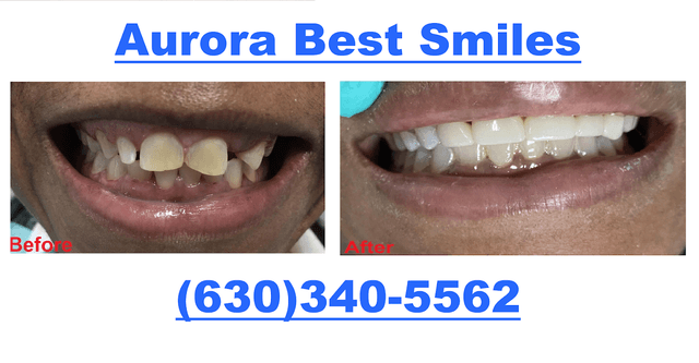 Aurora Best Smiles photo