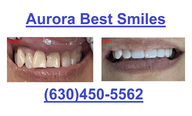Aurora Best Smiles photo