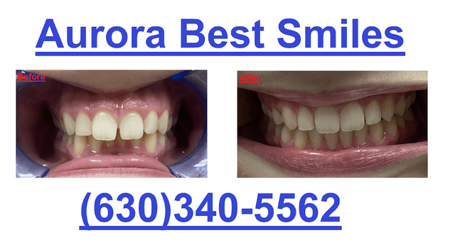 Aurora Best Smiles photo