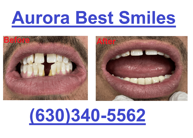 Aurora Best Smiles photo