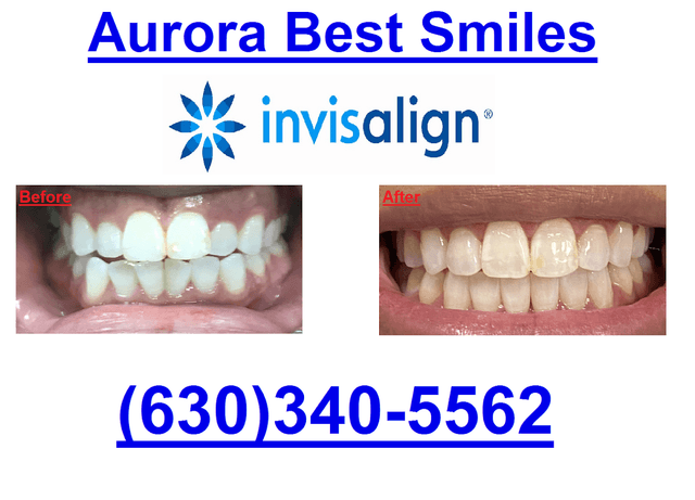 Aurora Best Smiles photo