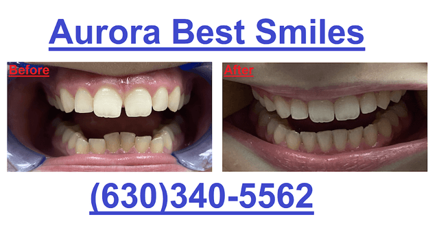 Aurora Best Smiles photo
