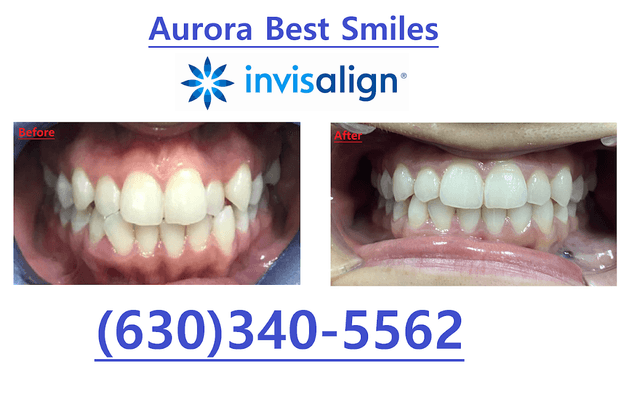 Aurora Best Smiles photo