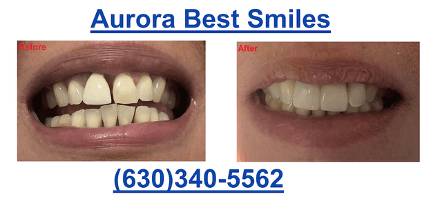 Aurora Best Smiles photo