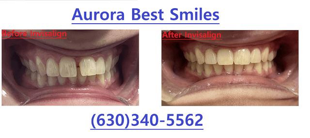 Aurora Best Smiles photo