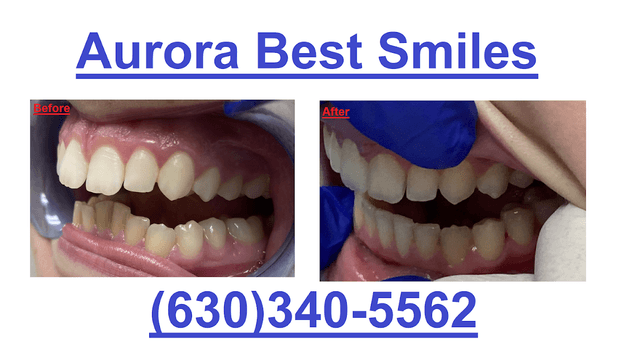 Aurora Best Smiles photo