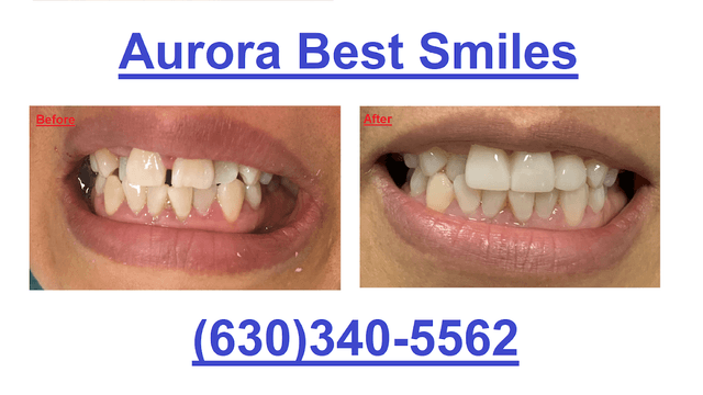 Aurora Best Smiles photo